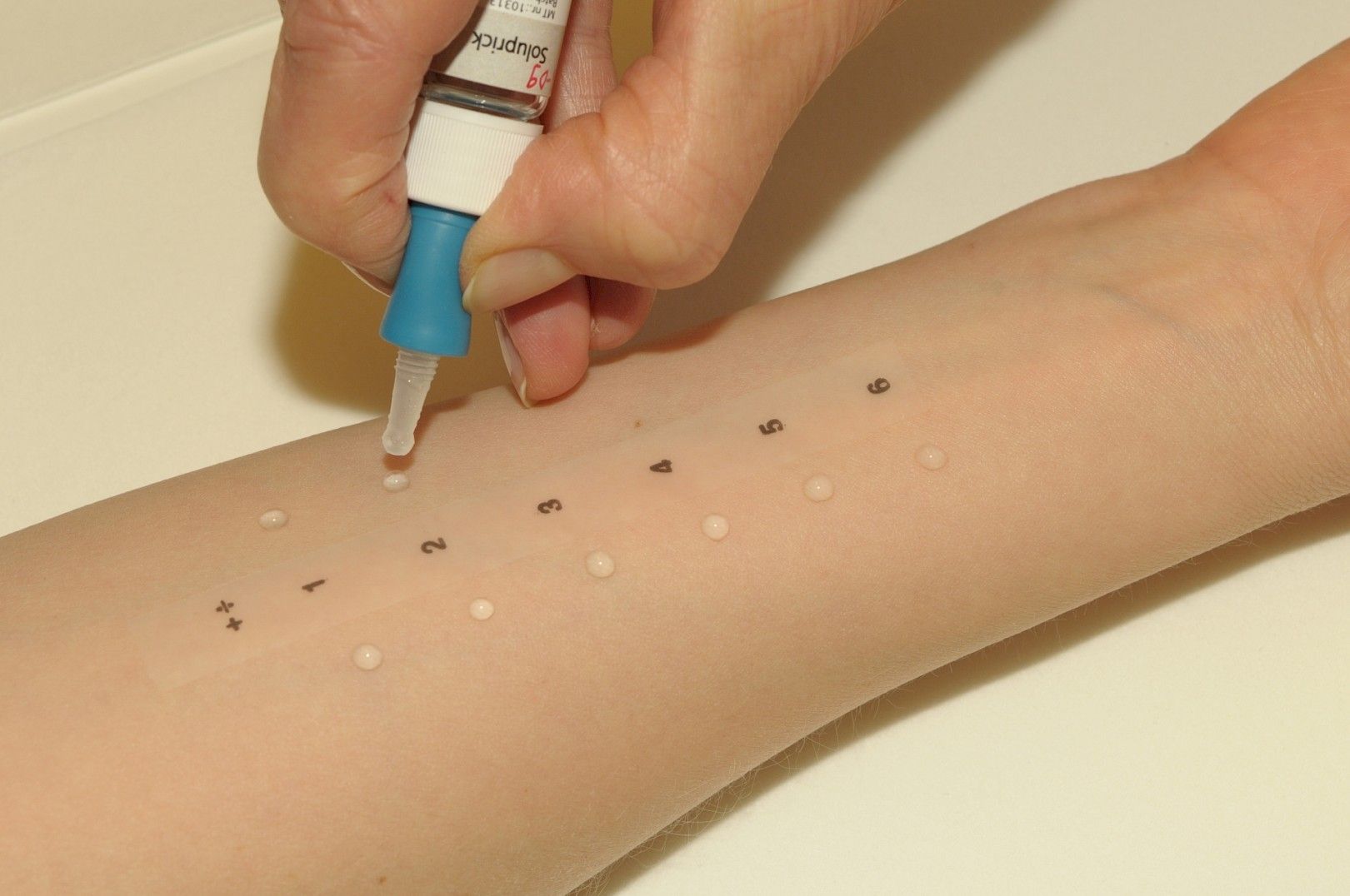 Tutustu 20+ imagen kissa allergiatesti apteekista